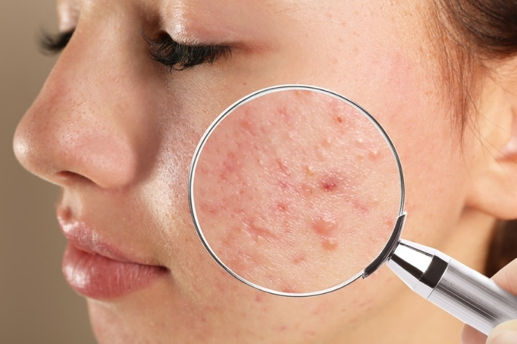 Medical Dermatology